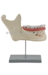 供应下颌神经及牙解剖模型-医学模型