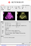 供应b超工作站软件