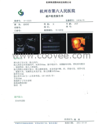 CT-9干膜  热敏胶片  相机输出