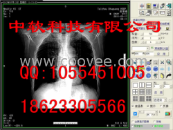 CT工作站CR工作站CR报告软件X光机软