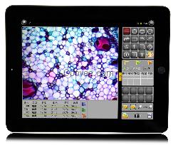 ScopePad-500智能数码显微成像