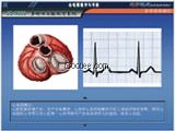 心电图教学与考核软件、心电图教学系统