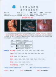 B超胶片、彩超胶片、激光打印胶片、打印胶