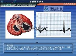 心电图教学与考核软件系统、心电图教学光盘