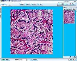 病理图文报告系统