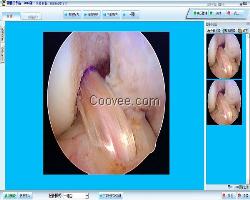 关节镜图文工作站