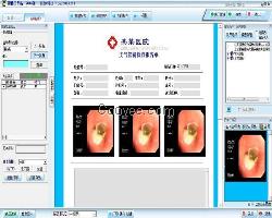 支气管镜图文工作站