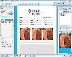 胃肠镜图文工作站