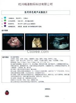 新型医用彩超胶片